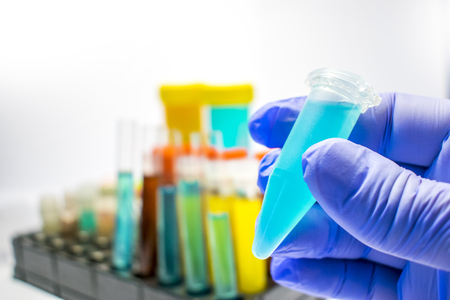 colorful laboratory test tubes, biochemistry blood tests, urine test,  tests tube, medical analysis, research concept, fertility research, stem cell fluidsの写真素材