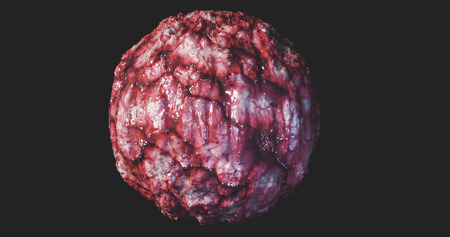Cancer Cell Oncology concept cancer tumor cyst carcinoma lymphoma colon cancer brest cancers  3d renderingの写真素材