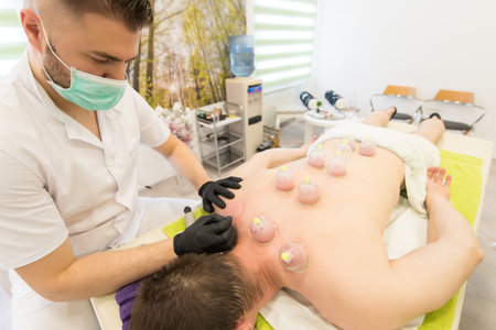 Young man laying down at the massage table and doing hijama treatment