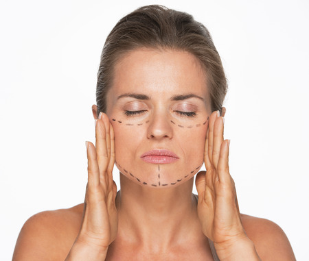 Woman with plastic surgery marks on faceの写真素材