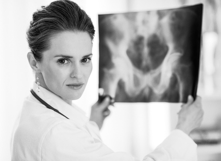 Portrait of medical doctor woman with fluorographyの写真素材