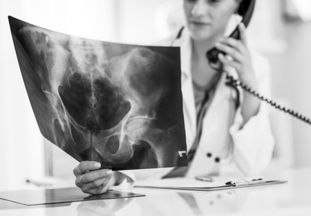 Closeup on medical doctor woman looking on fluorography and talking phone