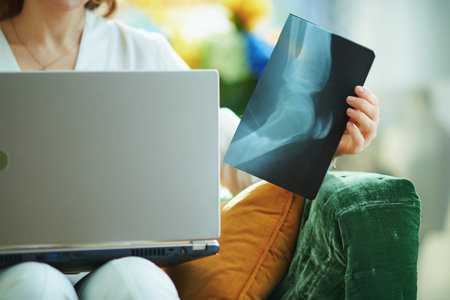 Closeup on female with x-ray speaking with doctor using telehealth technology in the living room in...