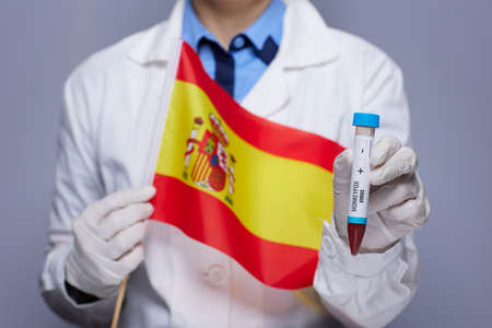 female medical doctor in white medical robe with monkeypox test tube and French flag isolated on gray background.の写真素材