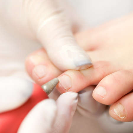 Chiropodyの写真素材