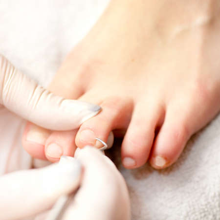 Chiropodyの写真素材