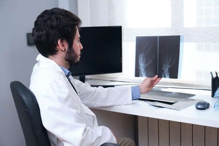 Young doctor examining x-ray of hands. Radiography of a hand.の写真素材