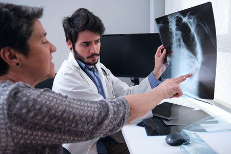 Young doctor examining x-ray of a broken rib with a woman mature patient. Radiography of a chest.の写真素材