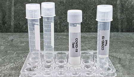 Test tube with Covid-19 label. Microbiology laboratory equipment. Coronavirus, Covid-19 test
