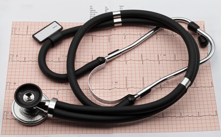 Stethoscope on electrocardiogram in paper form. Heart disease prevention.の写真素材