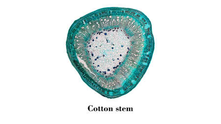 Light photomicrograph of Cotton stem cross section seen through microscope