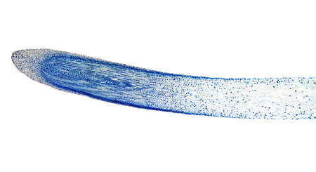 Light photomicrograph of Mitosis of onion root tip cells seen through microscope