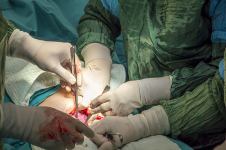 surgery in operation room performed by doctors