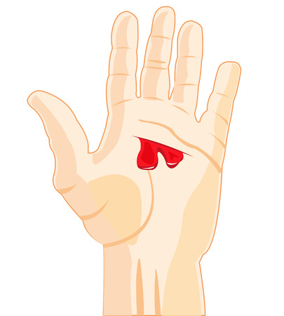The Palm of the person with wound and blood.Vector illustrationのイラスト素材