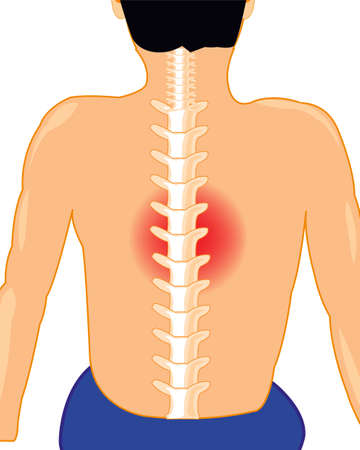 Man with sick spine on white background is insulatedのイラスト素材