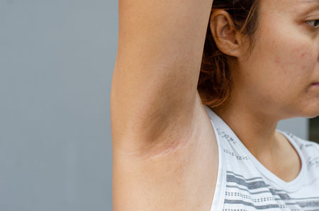 young asia woman her hand up and shows the area of the dark or dull armpits, health care concept