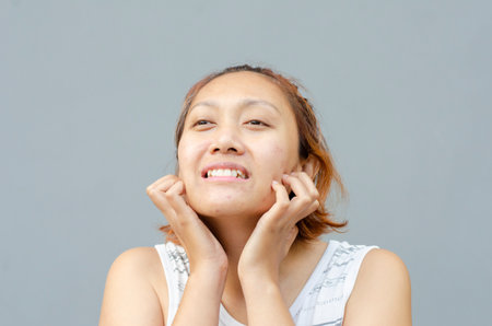 young asian woman scratching itch with hand on face or cheek area, health care concept, dermatosisの写真素材