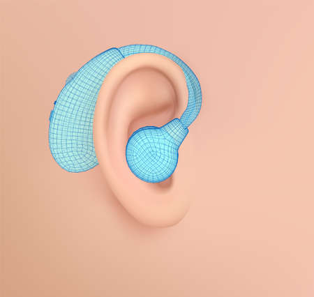 vector human ear. hearing treatment, plastic surgery, implantationのイラスト素材