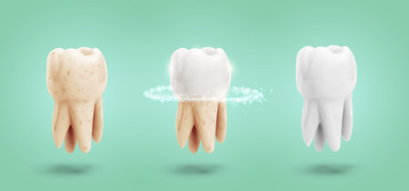 vector set of three molars. tooth cleaning, care and protection from tooth decay.のイラスト素材
