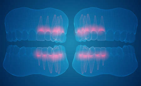 human jaw. 3d vector layout. medicine and health. pain teeth.