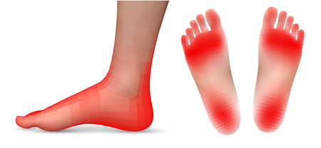 vector set of legs with red patches of pain on a white backgroundのイラスト素材
