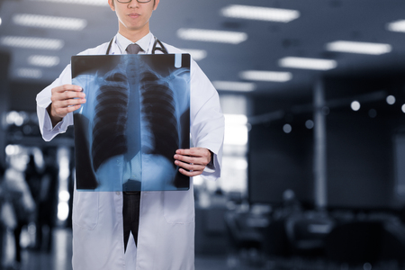 doctor holding film x-ray in hospitalの写真素材