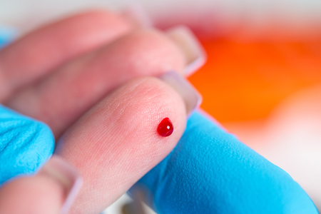 Taking blood for close-up analysis, a clinical blood testの写真素材