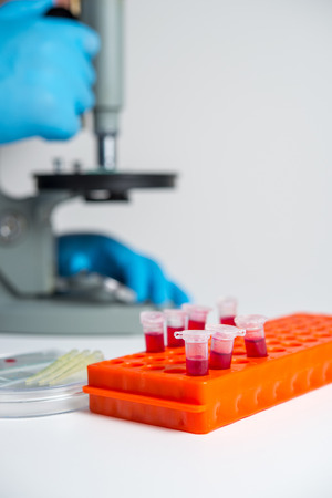 Test tubes with blood for analysis and research in the laboratoryの写真素材