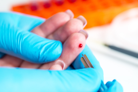 Taking blood for close-up analysis, a clinical blood testの写真素材