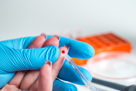 Taking blood for close-up analysis, a clinical blood testの写真素材