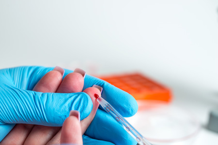Taking blood for close-up analysis, a clinical blood testの写真素材