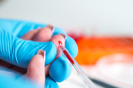 Taking blood for close-up analysis, a clinical blood testの写真素材
