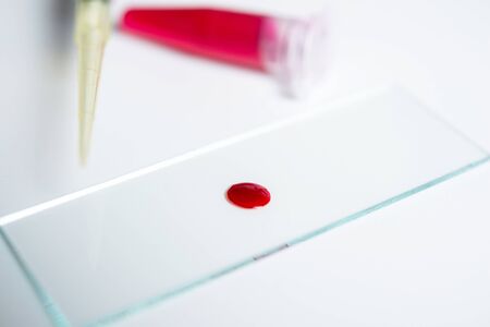 A drop of blood in a test tube for the research and analysisの写真素材