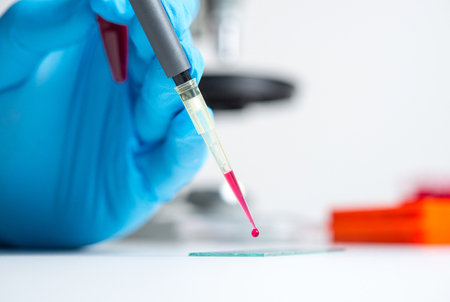 A drop of blood for the study and examination of medical laboratoryの写真素材