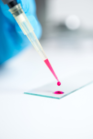 A drop of blood for the study and examination of medical laboratoryの写真素材
