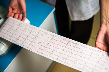 cardiogram close-up in doctors handsの写真素材