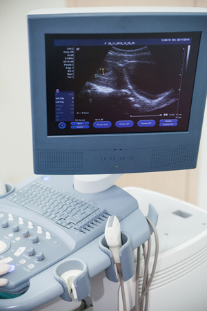 Ultrasound machine doctor"s hand usg inverstigationの写真素材