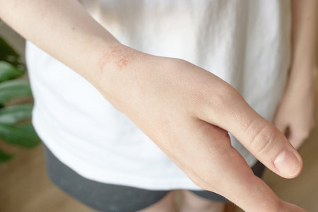 Close-up of skin with allergic skin disease