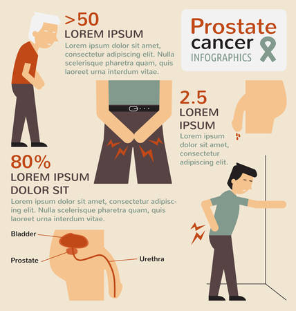 Prostate cancer infographicsのイラスト素材