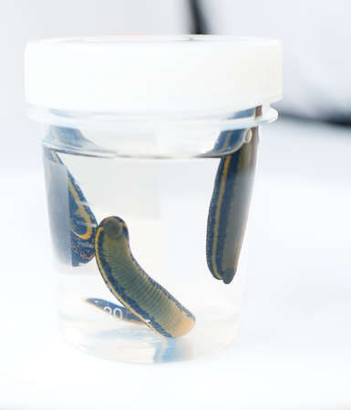 Hirudotherapy. medical leeches in a glass in waterの写真素材
