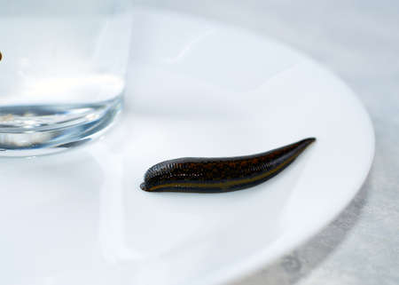 Hirudotherapy procedure, hirudotherapy, leeches as therapy, prevention of varicose veins