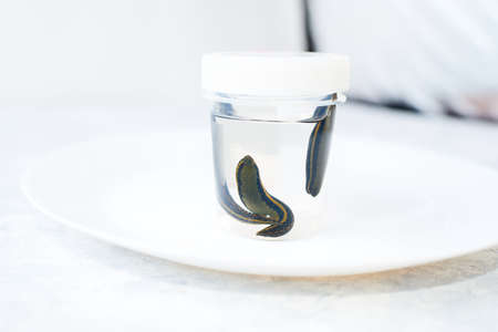 Hirudotherapy. Medical leeches in water before therapyの写真素材