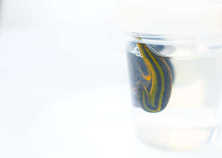 Bank with leeches - hirudotherapy, medical leeches in a glass in waterの写真素材