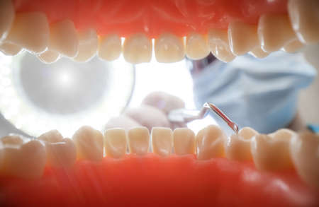 Patient at a dentist appointment in a dental clinic. View from inside the dental jaw.