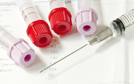 Medical Blood tube, test tube for laboratory and syringe.の写真素材