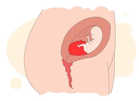 Illustration of a child growing in mother's belly.のイラスト素材