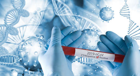 Image of test tube with coronavirus test in gloved hands.Test - positive. 3d illustration