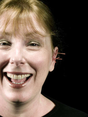 The Eastern or Asian acupuncture medical treatment said to prevent or treat a variety of medical ailments, including pain.  Ear needles and a happy patient.の写真素材