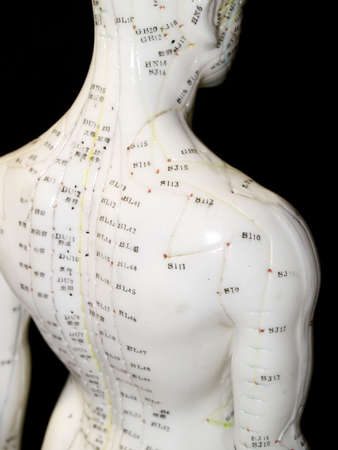 The Eastern or Asian acupuncture medical treatment said to prevent or treat a variety of medical ailments, including pain.の写真素材