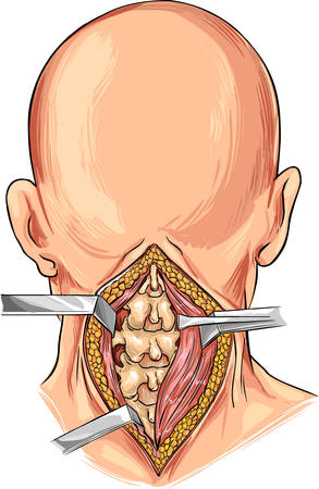 white background vector illustration of a Cervical Spineのイラスト素材